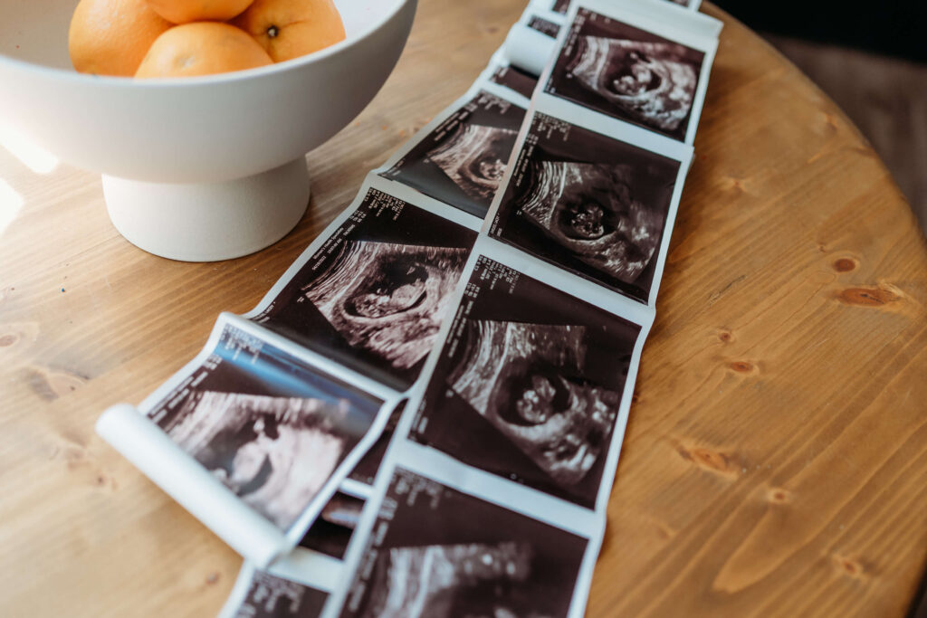 When to take maternity photos during pregnancy showing an ultrasound photo.